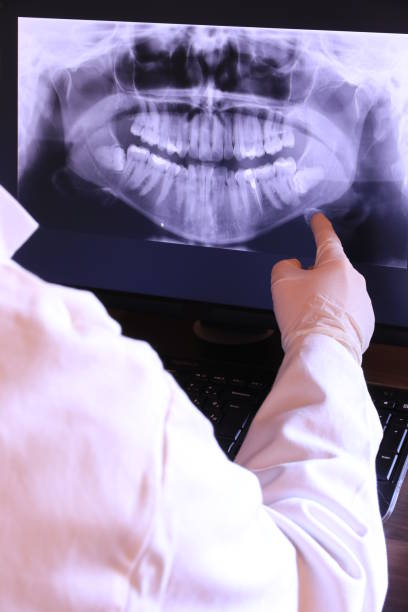 Best Broken or Chipped Tooth Repair in Apple Creek, OH