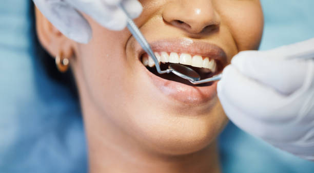 Best Emergency Denture Repair in Apple Creek, OH