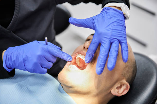 Best Broken or Chipped Tooth Repair in Apple Creek, OH
